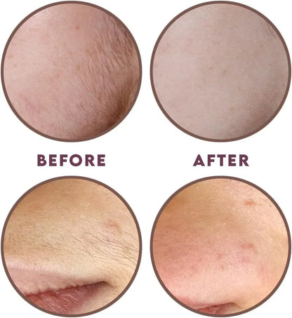 ThreadLux™ Hair Threading System – Smooth, Painless Face & Body Removal